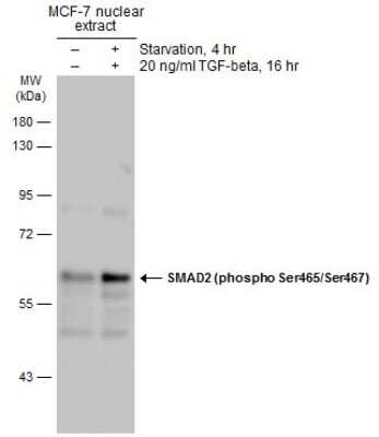 Western Blot: Smad2 [p Ser465, p Ser467] Antibody [NBP3-13273] - Untreated (-) and treated (+) MCF-7 whole cell extract (30 ug) were separated by 10% SDS-PAGE, and the membrane was blotted with Smad2 (phospho Ser465/Ser467) antibody (NBP3-13273) diluted at 1:1000. The HRP-conjugated anti-rabbit IgG antibody (NBP2-19301) was used to detect the primary antibody.